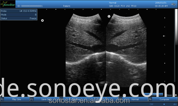 image for labtop ultrasound